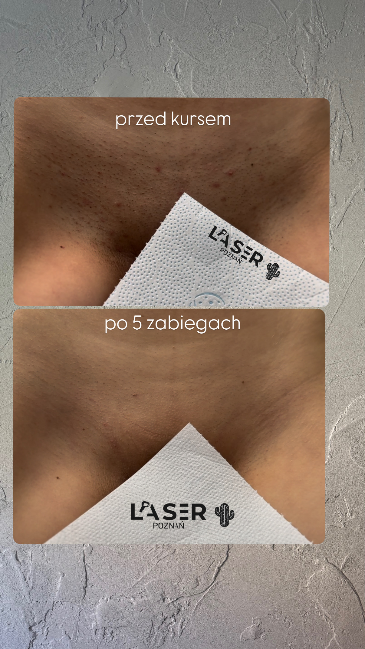 before-after