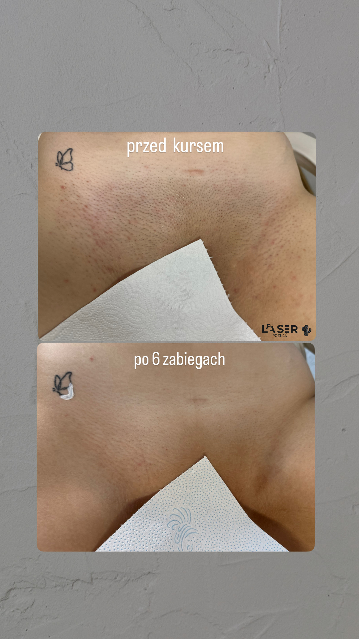 before-after