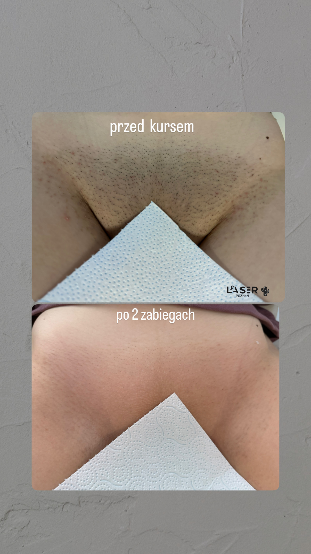 before-after