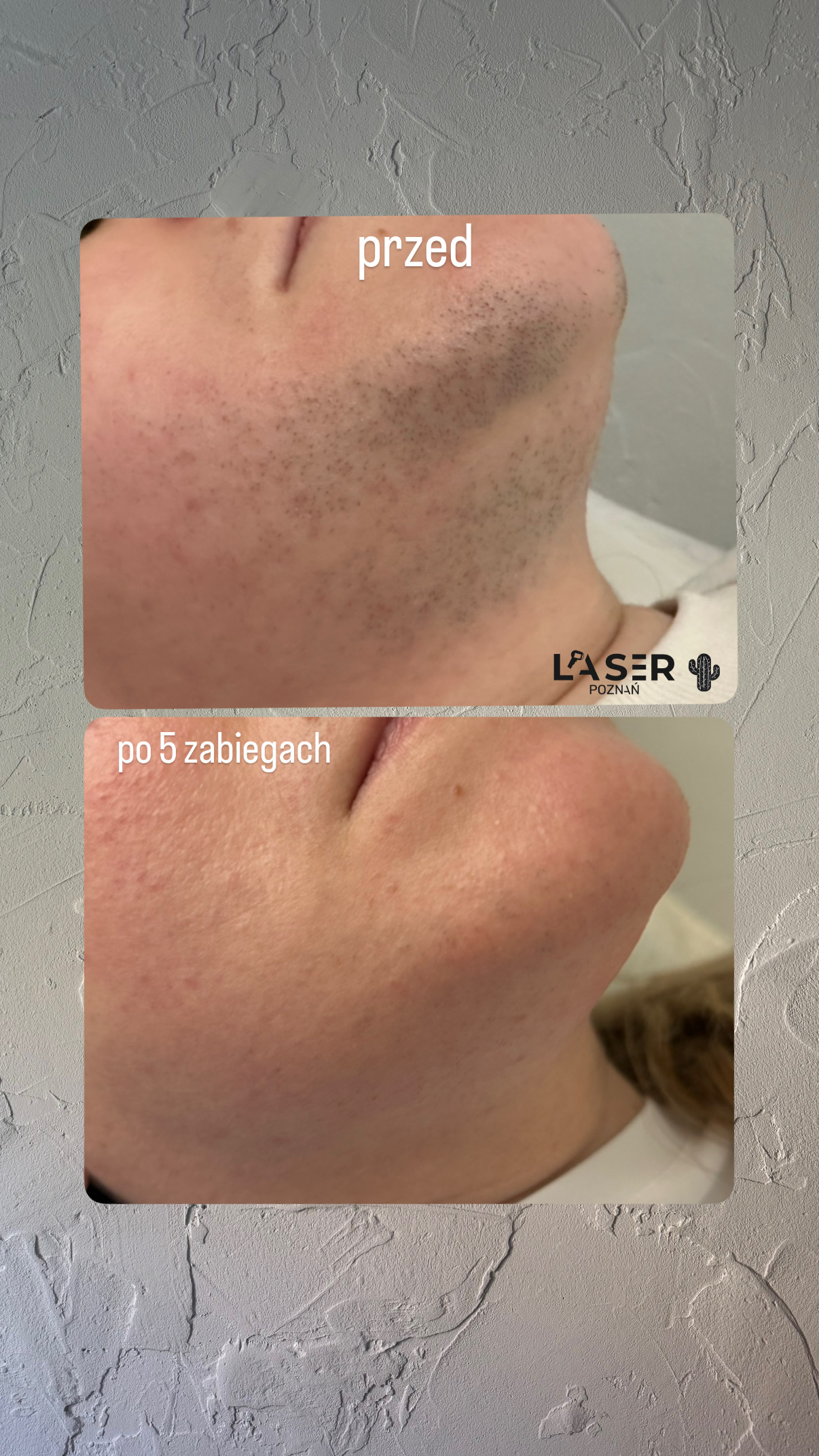 before-after