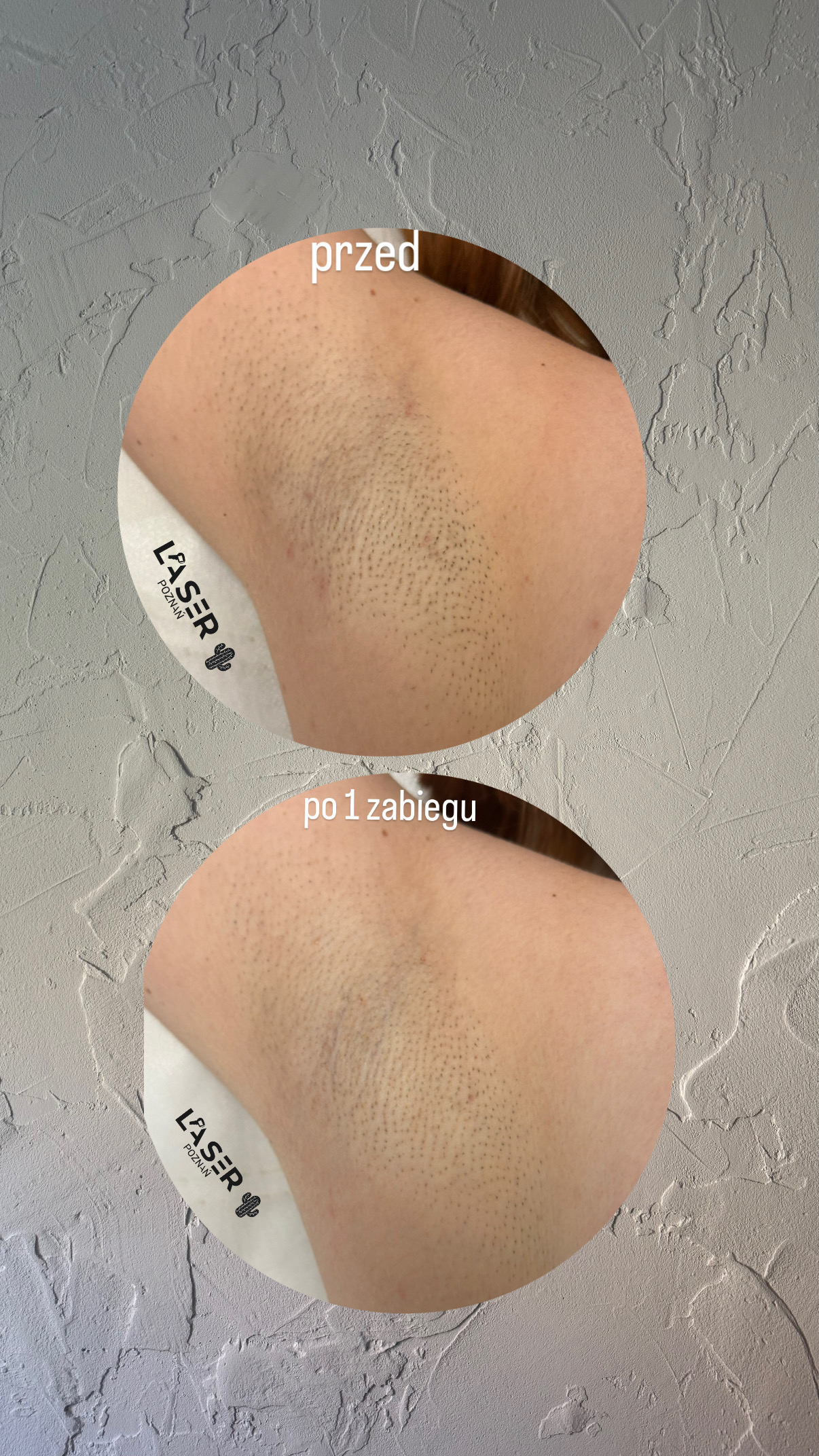before-after