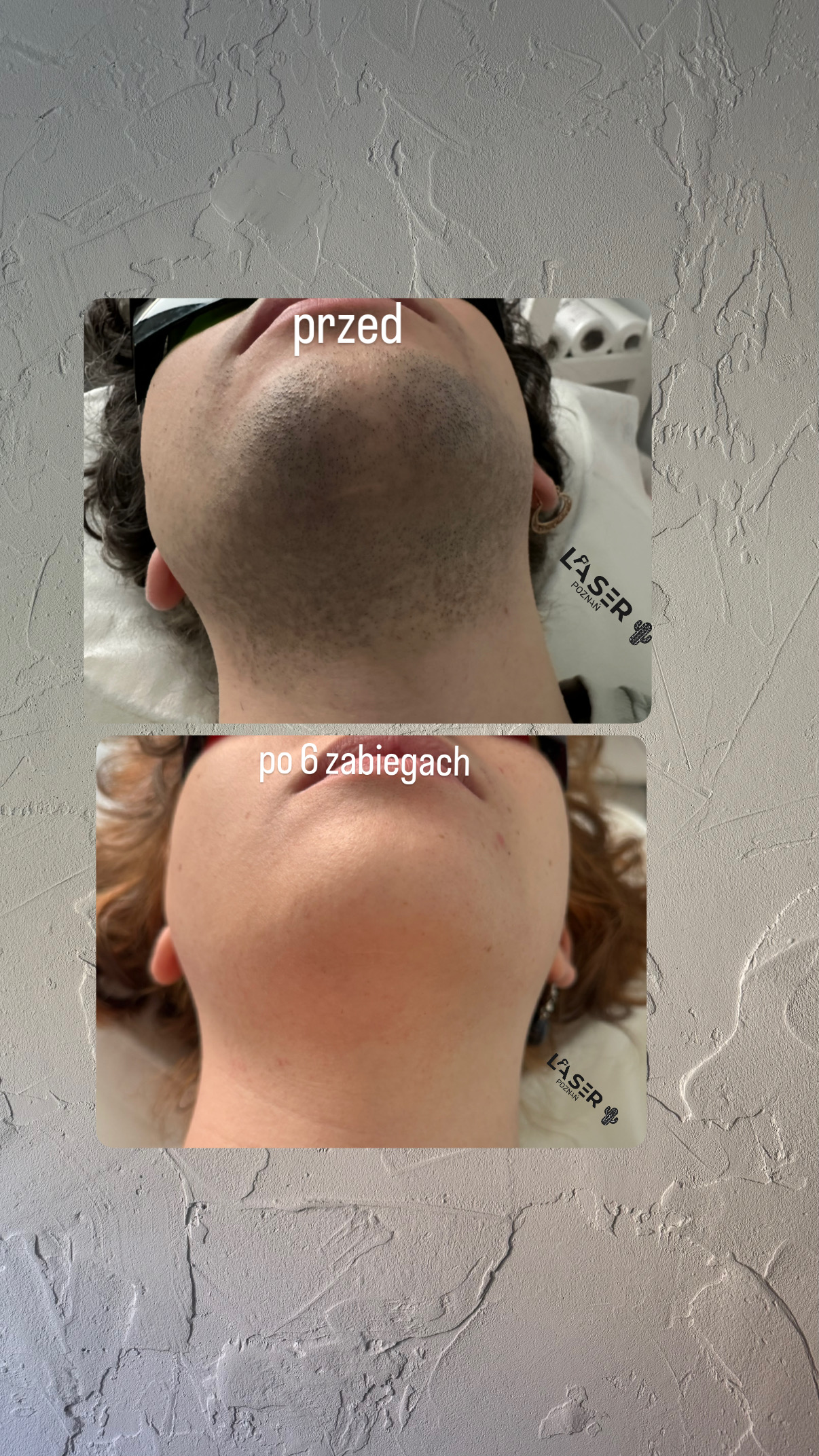 before-after